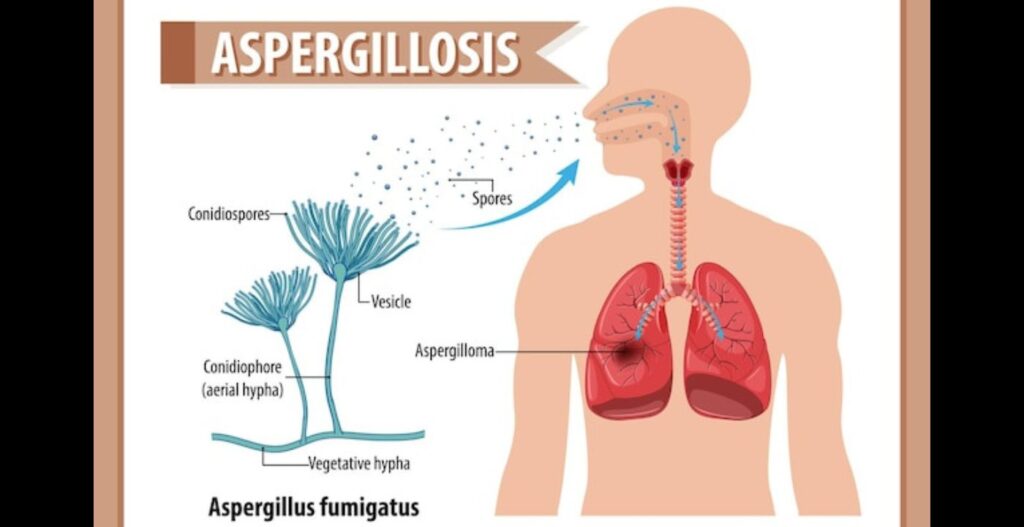 How to Improve Your Lung Health: Tips for a Breath of Fresh Air